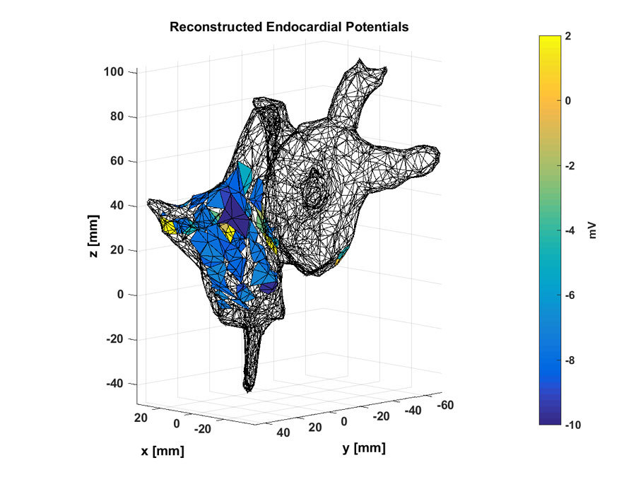 Doctors can use these noninvasive maps of electrochemical potentials inside a patient's heart to localize the source of an abnormal heart rhythm. Credit: Abhejit Rajagopal