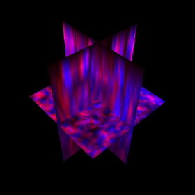 This image shows a stained kidney sample imaged on a two-photon microscope with blue representing nuclei and red cytoplasm.