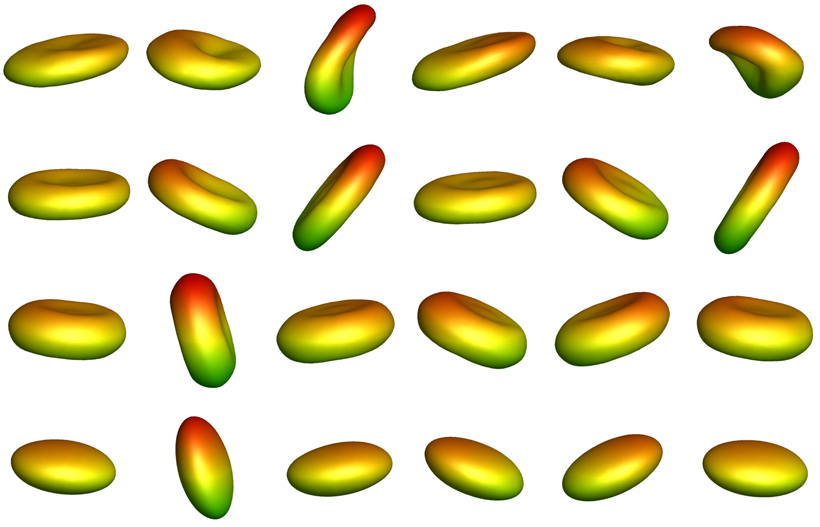 Dynamic behaviors of healthy-stage (first row), ring-stage (second row), trophozoite-stage (third row), and schizont-stage (fourth row) erythrocytes in shear flow at a dimensionless shear rate of Ca = 0.08. <br/>CREDIT: T. Ye, N. Phan-Thien, B.C. Khoo, and C.T. Lim/NUS. Dynamic behaviors of erythrocytes