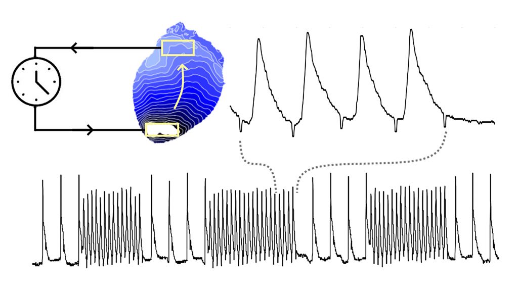 Controllable reentry in a light-sensitive heart: (top left) Activation map during fixed delay pacing; (top right) Alternans (beat-to-beat changes) in voltage; (bottom) The same plot over a longer period shows self-terminating bursts. CREDIT: Gil Bub