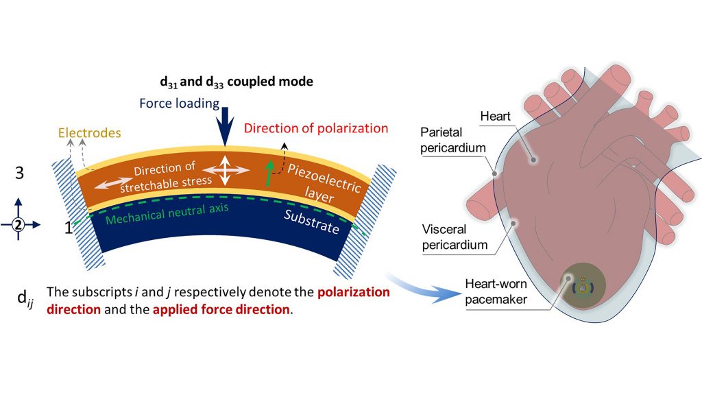 Researchers are investing batteryless powering and leadless pacing, harvesting kinetic energy from the heart to power pacemakers. The energy is harvested by the buckling of the encapsulated structure of the pacemaker, creating buckled piezoelectric energy.