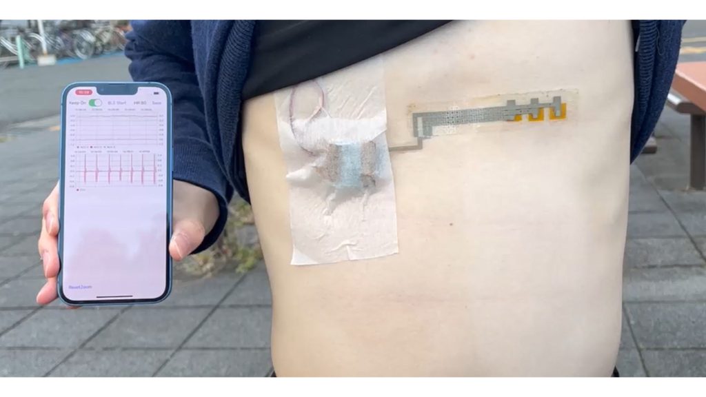 Wireless, wearable, and flexible electrocardiogram monitor with app data. CREDIT: Kuniharu Takei