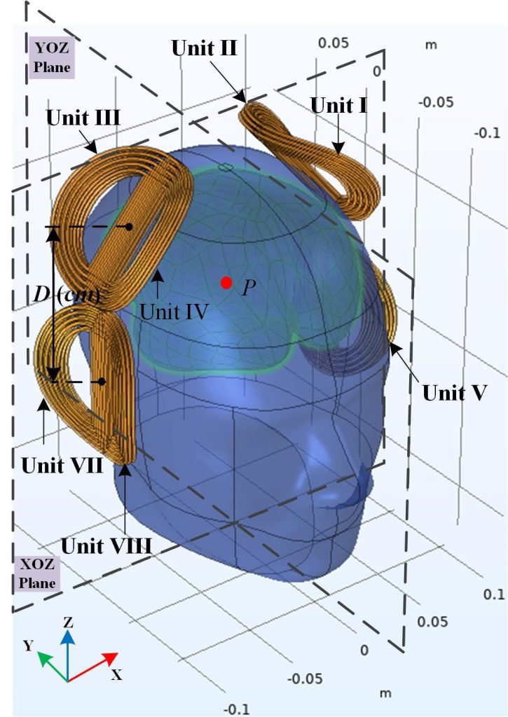 A new transcranial magnetic stimulation array with a special geometrical-shaped magnet structure reaches deeper brain tissue than conventional methods. CREDIT: Xiao Fang