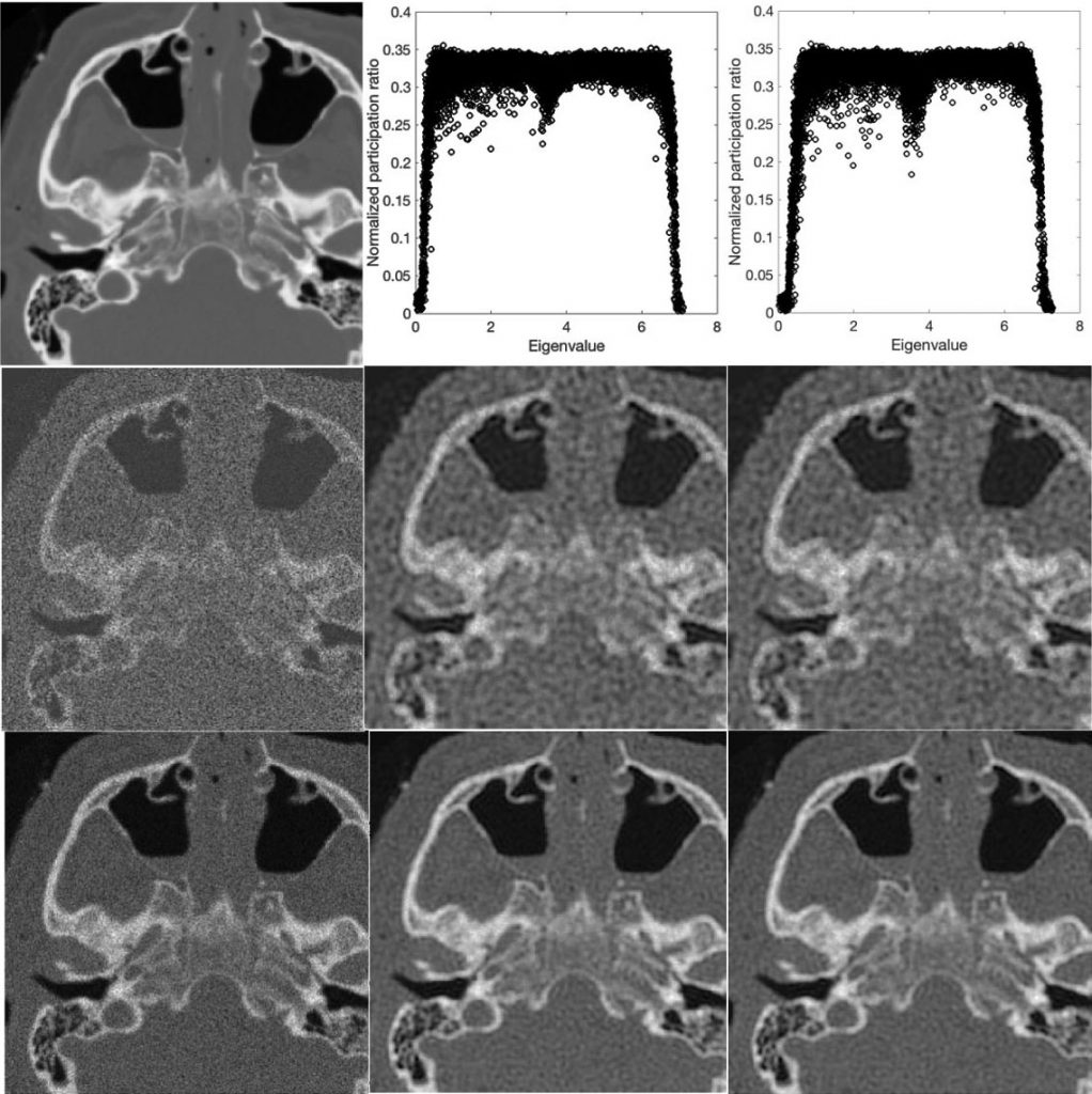 A medical image denoising method based on principles of quantum mechanics outperform machine learning, statistical methods, and neural networks. The same approach could aid quantum computing performance at scale. Credit: Hashemi et al. 