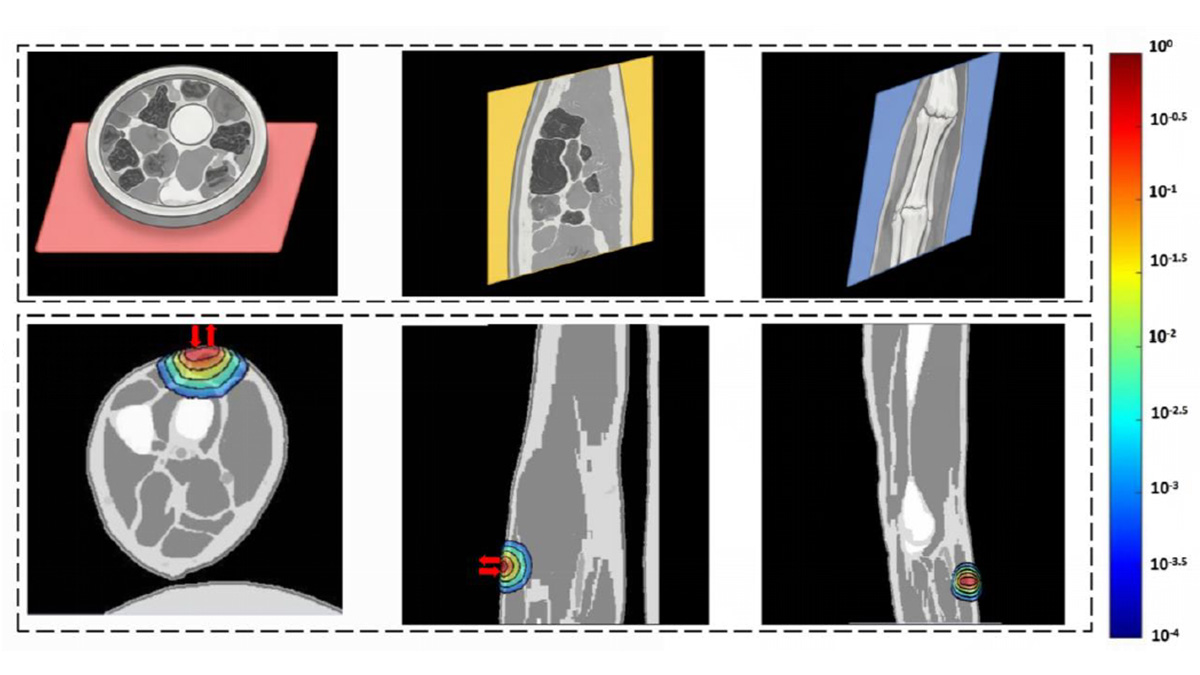 Near infrared optical measurements combined with a temperature-aware algorithm create an at-home skin hydration monitoring system that fills key gaps in skin care management. Credit: Yisong Xue et al.