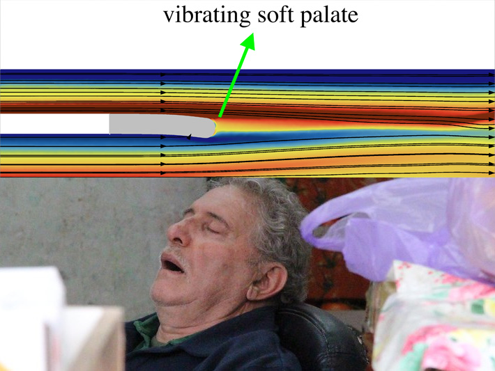 A simulation of airflow over the soft palate, which vibrates to produce sound, over an image of a man sleeping. Credit: Li et al. (graph), Mussi Katz via flickr, licensed under CC0 (photograph)